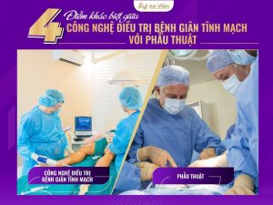 điều trị bệnh giãn tĩnh mạch