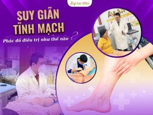 phác đồ điều trị suy giãn tĩnh mạch