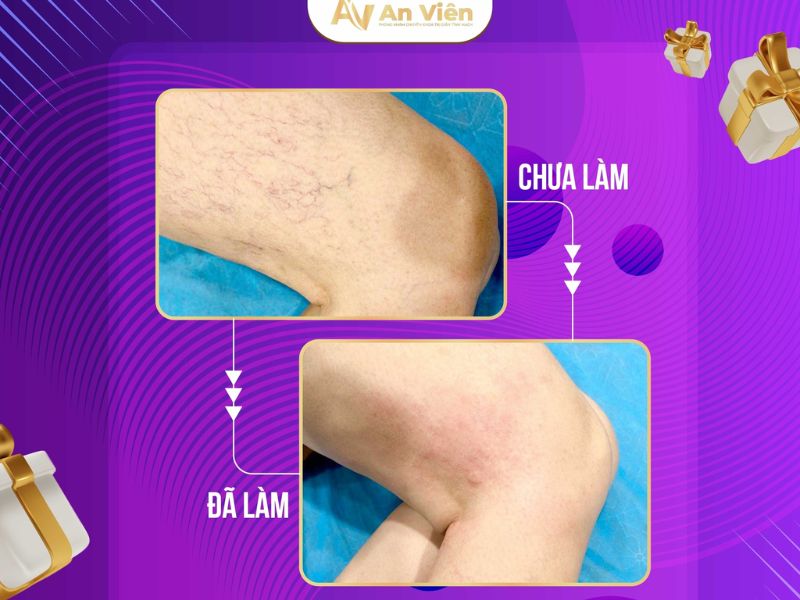 phòng khám tĩnh mạch