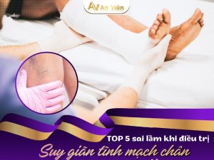 bệnh giãn tĩnh mạch