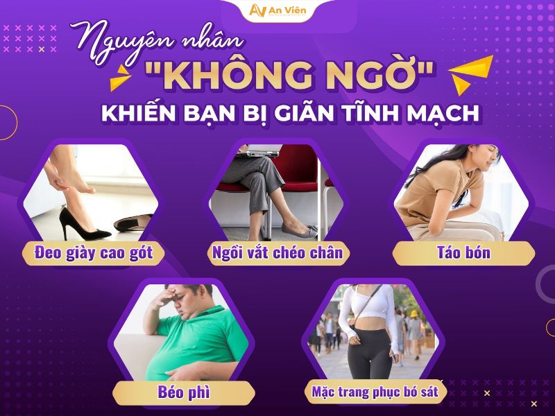 8 cách tự nhiên chữa giãn tĩnh mạch được chia sẻ “rần rần” 8 8 cách tự nhiên chữa giãn tĩnh mạch