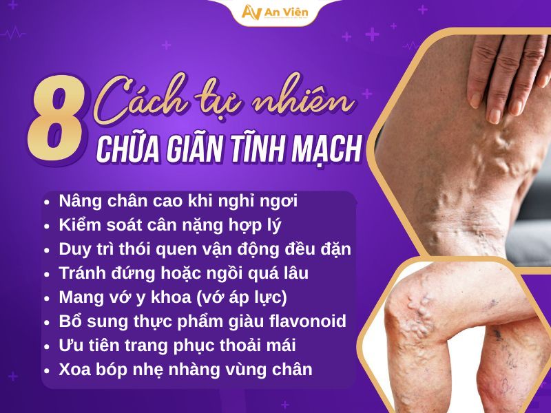 8 cách tự nhiên chữa giãn tĩnh mạch được chia sẻ “rần rần” 10 8 cách tự nhiên chữa giãn tĩnh mạch
