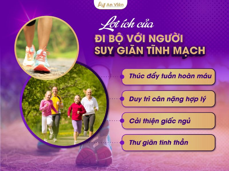 cách chữa bệnh giãn tĩnh mạch