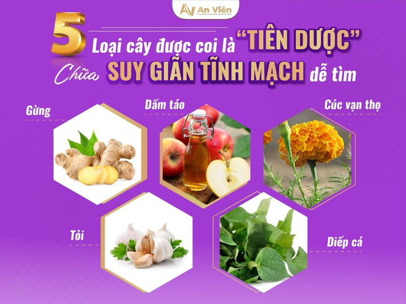 cách chữa bệnh giãn tĩnh mạch