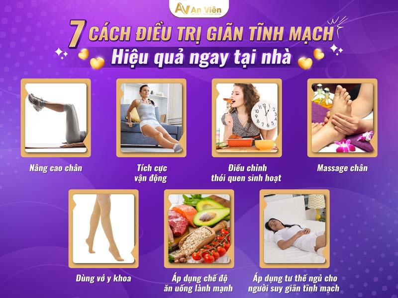 cách chữa bệnh giãn tĩnh mạch