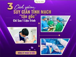 cách giảm suy giãn tĩnh mạch