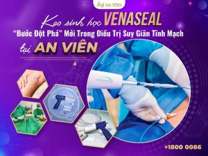 chữa giãn tĩnh mạch