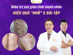 điều trị suy giãn tĩnh mạch chân