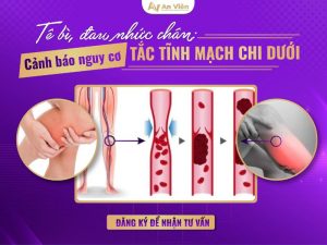 tắc tĩnh mạch chi dưới