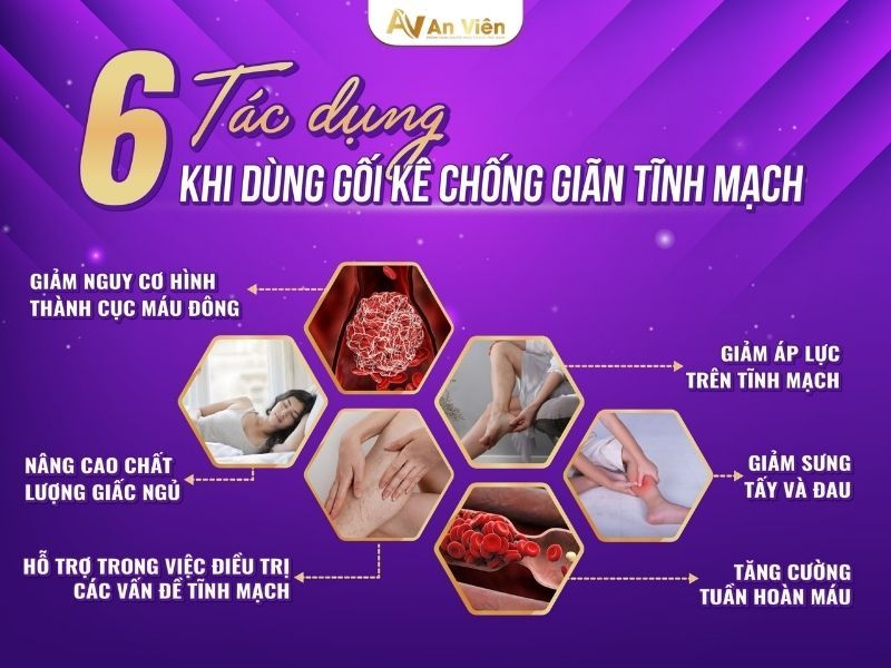 Bác sĩ giới thiệu 4 loại gối suy giãn tĩnh mạch tốt hiện nay 11 gối suy giãn tĩnh mạch