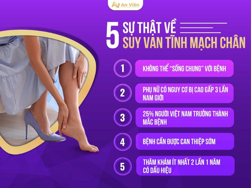 bệnh suy van tĩnh mạch chân