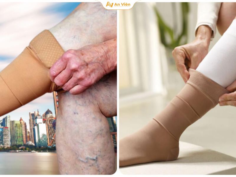 Vớ giãn tĩnh mạch loại nào tốt? Top 5 loại vớ chất lượng được bác sĩ khuyên dùng 17 Hướng dẫn mang vớ