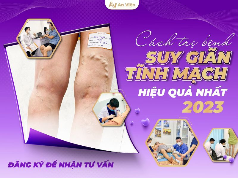 Tầm soát suy giãn tĩnh mạch với 0đ tại chuyên khoa An Viên Đà Nẵng 17 chuyên khoa An Viên Đà Nẵng