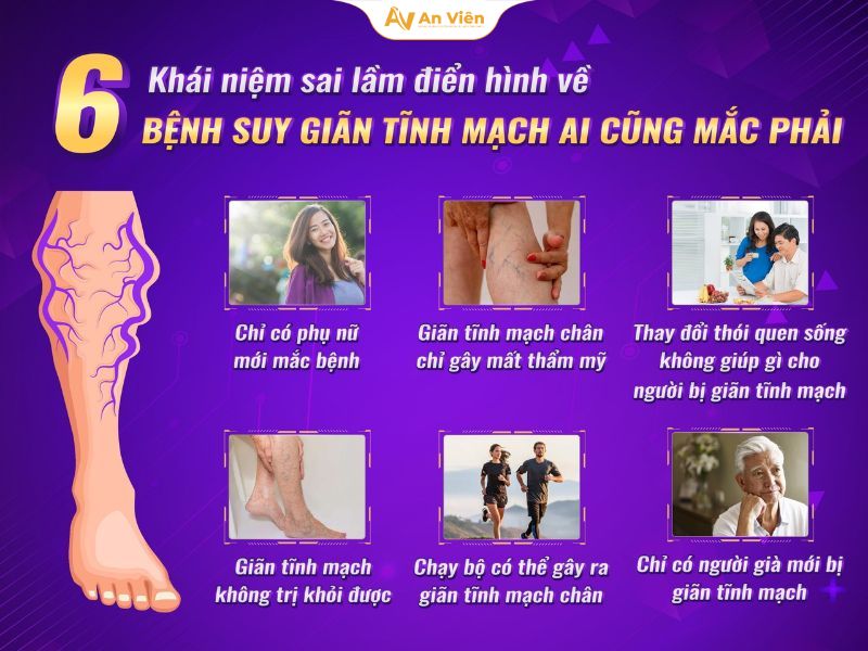 Suy van tĩnh mạch là gì? Hiểu đúng để phòng và điều trị kịp thời 16 Sai lầm về suy van tĩnh mạch