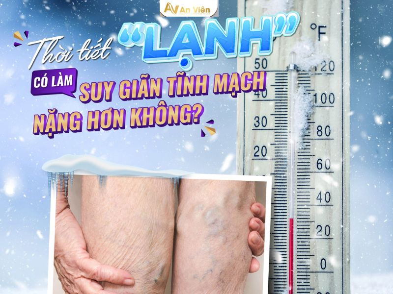 Trị giãn tĩnh mạch chân vào mùa đông cần chú ý 10 điều sau 10 trị giãn tĩnh mạch chân