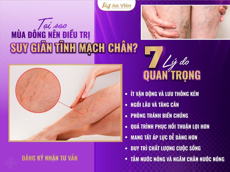 Trị giãn tĩnh mạch chân vào mùa đông cần chú ý 10 điều sau 11 trị giãn tĩnh mạch chân