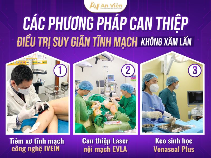 Trị giãn tĩnh mạch chân vào mùa đông cần chú ý 10 điều sau 17 trị giãn tĩnh mạch chân