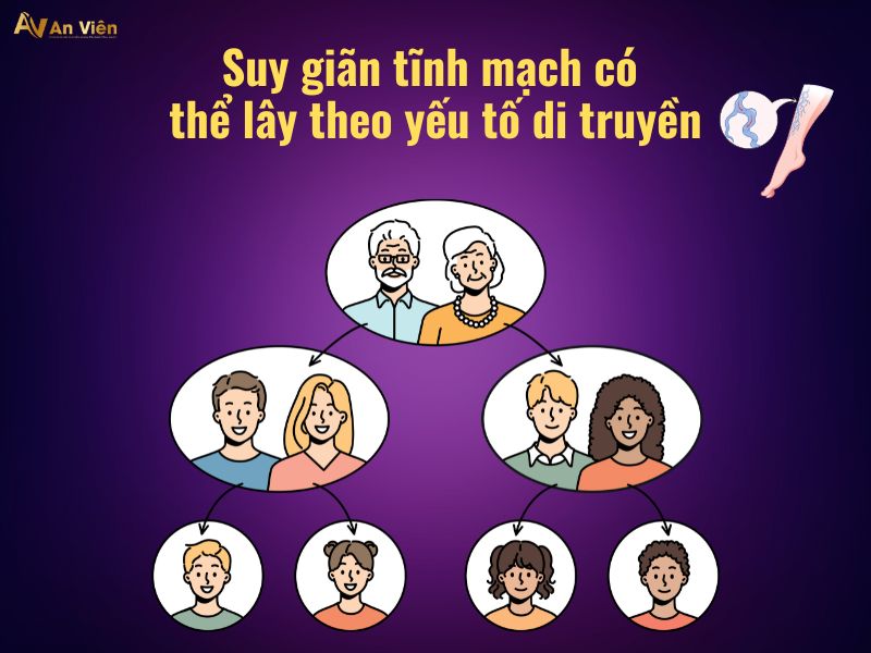 Bệnh giãn tĩnh mạch là như thế nào? Cần hiểu và xử lý đúng 12 bệnh giãn tĩnh mạch là như thế nào