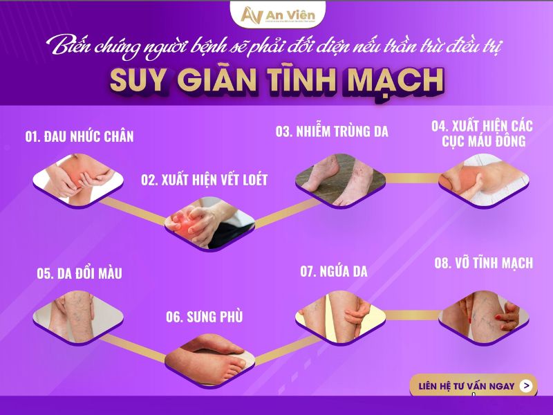 Bệnh giãn tĩnh mạch là như thế nào? Cần hiểu và xử lý đúng 15 bệnh giãn tĩnh mạch là như thế nào