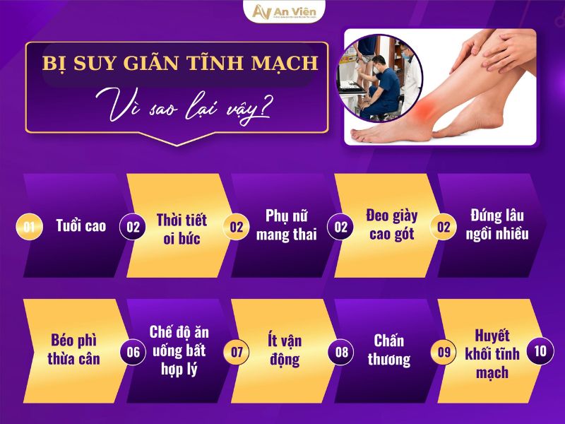 Nắm rõ cách chữa tĩnh mạch chân với 5 “KHÔNG” 9 cách chữa tĩnh mạch chân