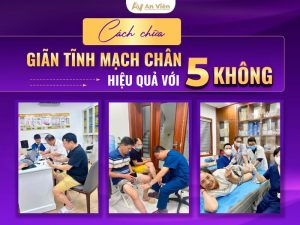 cách chữa tĩnh mạch chân