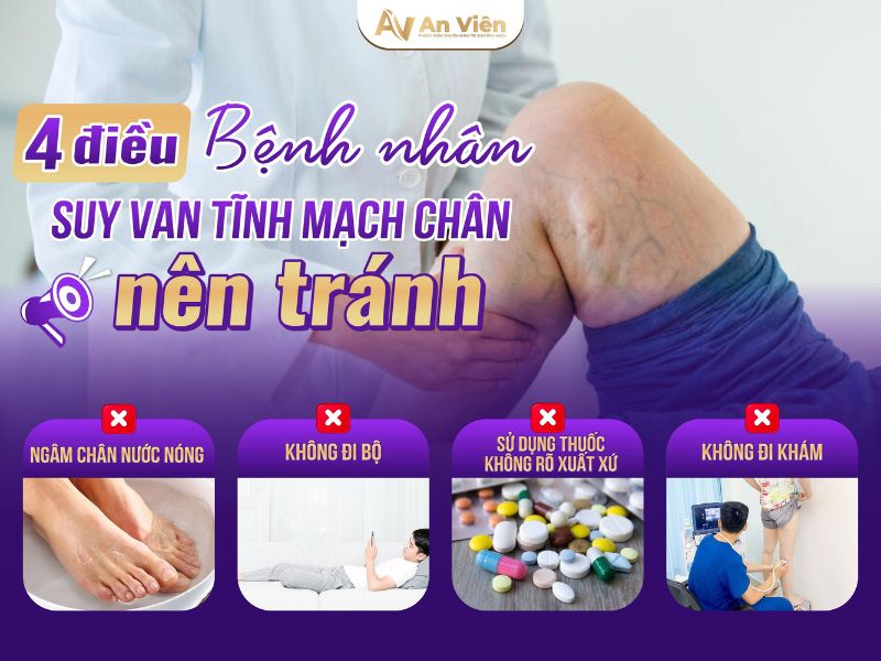 Nắm rõ cách chữa tĩnh mạch chân với 5 “KHÔNG” 13 cách chữa tĩnh mạch chân