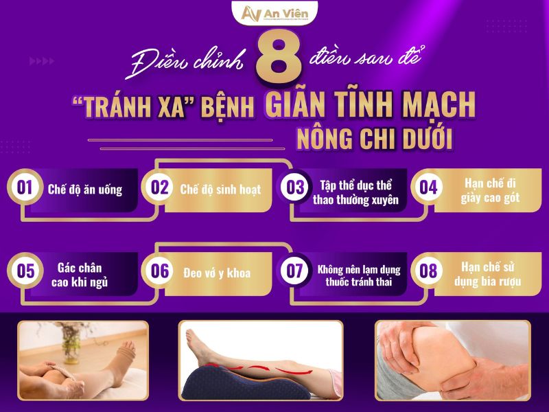 Nắm rõ cách chữa tĩnh mạch chân với 5 “KHÔNG” 14 cách chữa tĩnh mạch chân