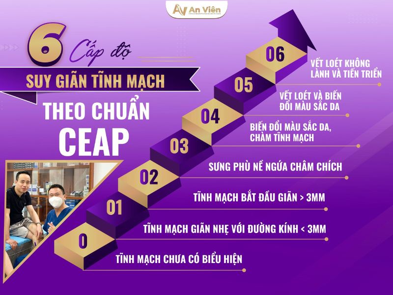 Bác sĩ hướng dẫn trị suy giãn tĩnh mạch mạn tính chi dưới với 5 phương pháp 16 suy tĩnh mạch mạn tính chi dưới