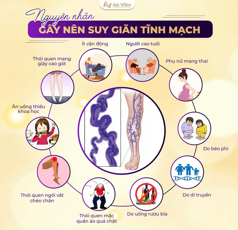bị tắc tĩnh mạch chân phải làm sao
