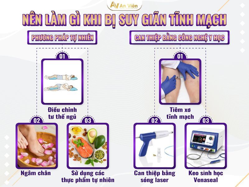 bị tắc tĩnh mạch chân phải làm sao