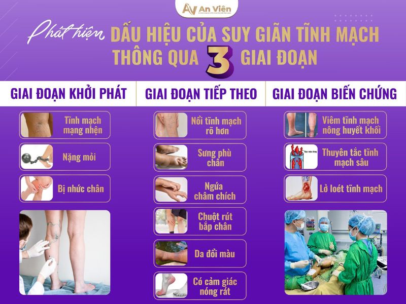 nguyên nhân giãn tĩnh mạch