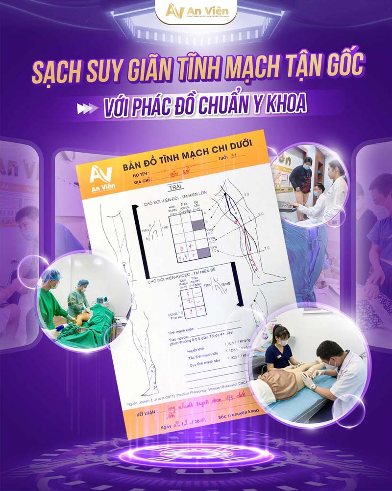 siêu âm tĩnh mạch chi dưới 1