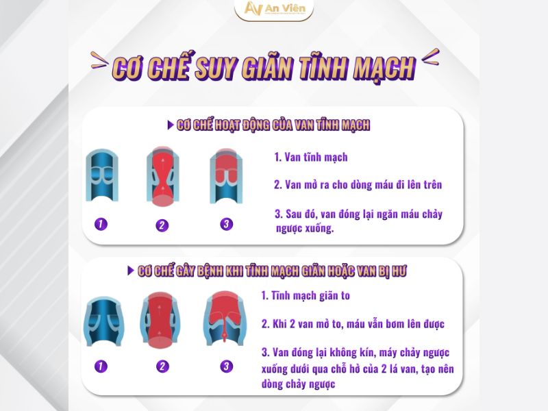 siêu âm tĩnh mạch chi dưới