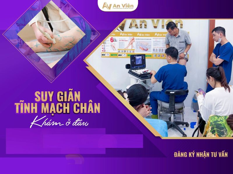 6 phòng khám, bệnh viện trị suy giãn tĩnh mạch uy tín 11 bệnh viện trị suy giãn tĩnh mạch