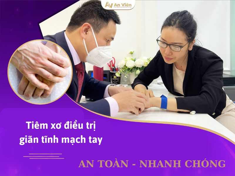 Cách điều trị nổi gân mu bàn tay bằng tiêm xơ: 5 ưu điểm nổi bật 19 cách điều trị nổi gân mu bàn tay