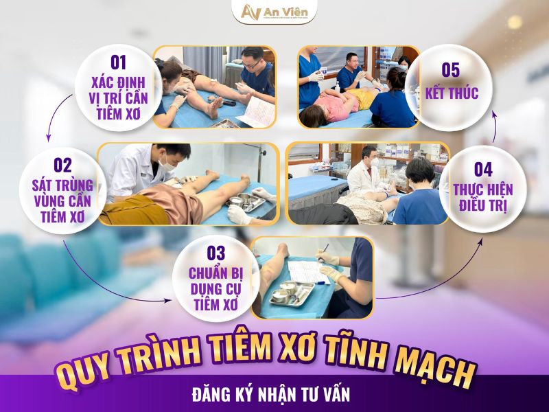 Cách điều trị nổi gân mu bàn tay bằng tiêm xơ: 5 ưu điểm nổi bật 22 cách điều trị nổi gân mu bàn tay