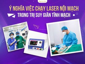 chạy laser nội mạch