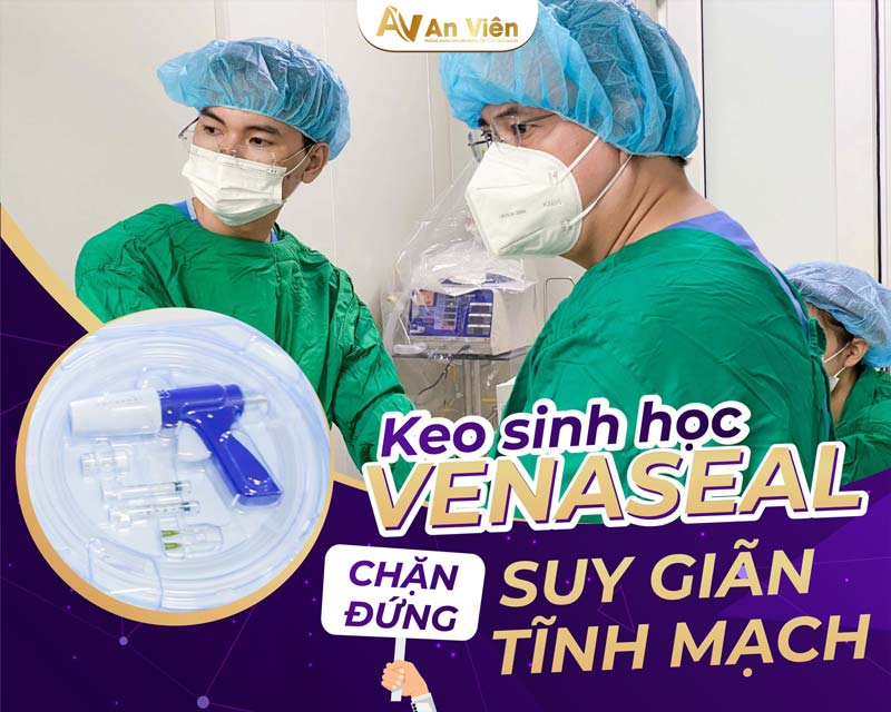 An Viên điều trị giãn tĩnh mạch chi dưới bằng keo sinh học 14 điều trị giãn tĩnh mạch chi dưới