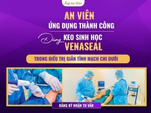 điều trị giãn tĩnh mạch chi dưới