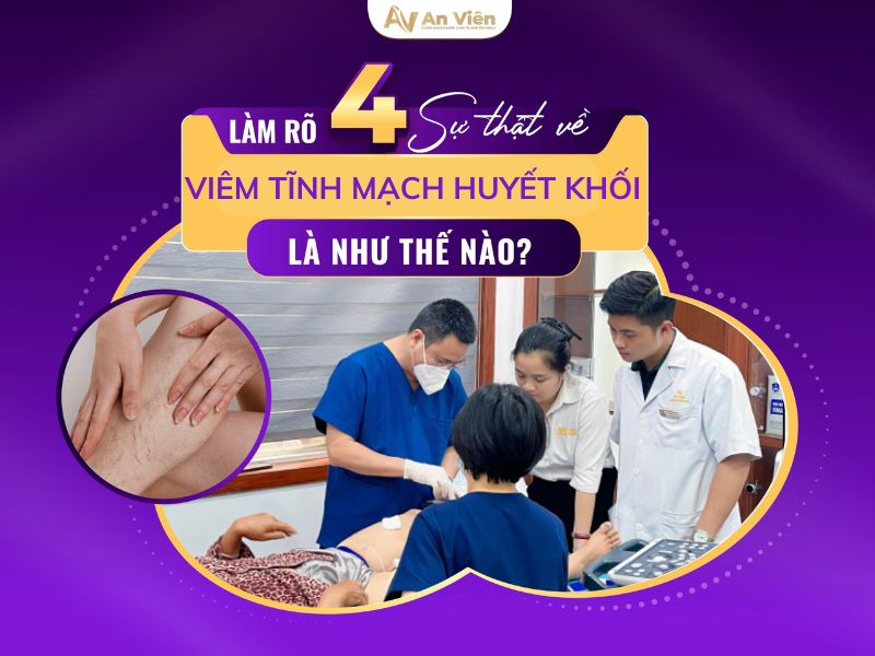 Lắng nghe bác sĩ lý giải nên hiểu viêm tĩnh mạch huyết khối như thế nào? 9 viêm tĩnh mạch huyết khối