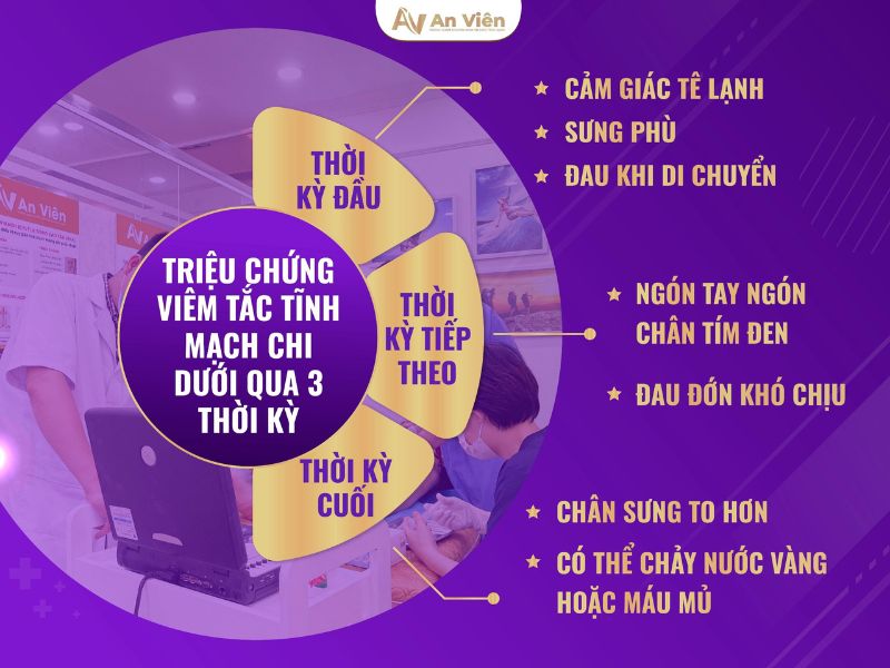 Lắng nghe bác sĩ lý giải nên hiểu viêm tĩnh mạch huyết khối như thế nào? 12 viêm tĩnh mạch huyết khối