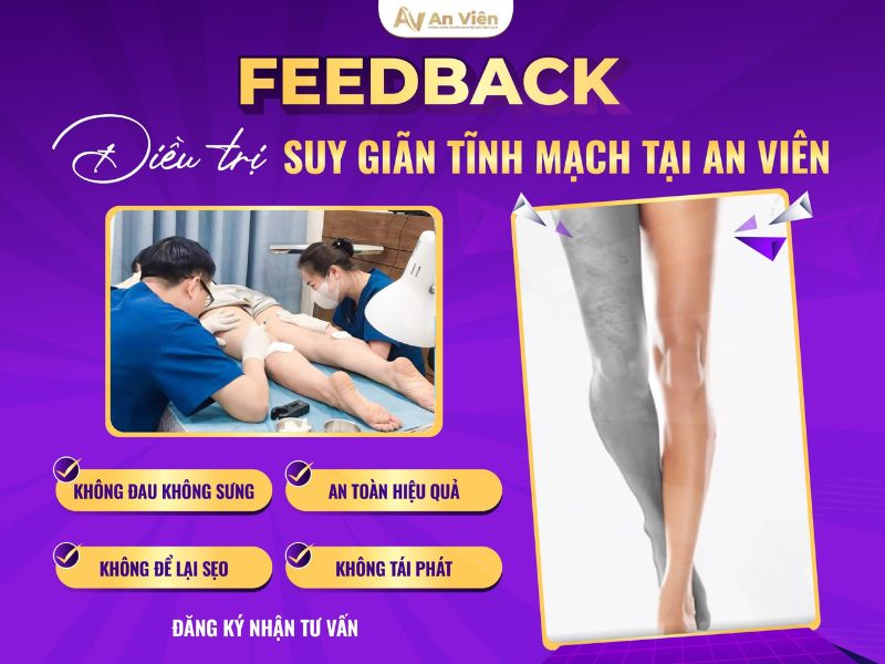Tại An Viên: Bệnh giãn tĩnh mạch và cách điều trị hiệu quả 11 bệnh giãn tĩnh mạch và cách điều trị