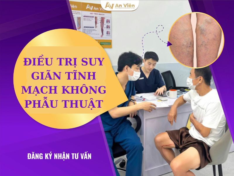 bệnh suy tĩnh mạch có chữa được không