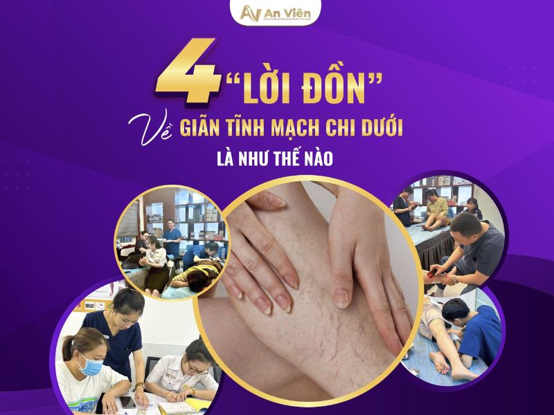 bệnh suy tĩnh mạch có chữa được không