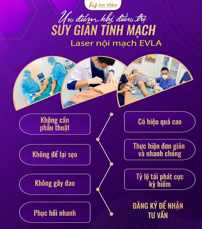 biểu hiện giãn tĩnh mạch ở chân
