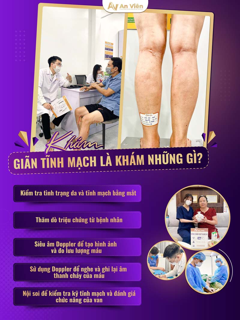 biểu hiện giãn tĩnh mạch ở chân