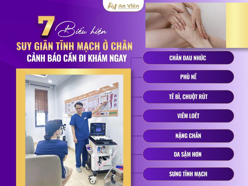 biểu hiện giãn tĩnh mạch ở chân