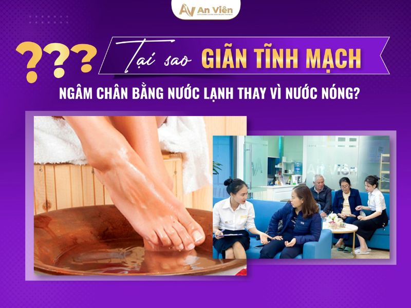 Điểm tên 9 cách chống giãn tĩnh mạch chân tại nhà đơn giản 13 cách chống giãn tĩnh mạch chân