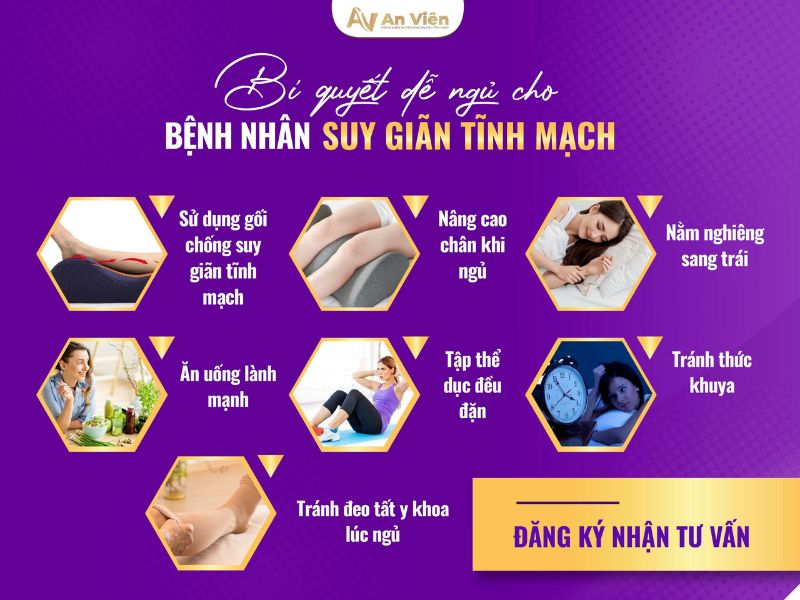 Điểm tên 9 cách chống giãn tĩnh mạch chân tại nhà đơn giản 14 cách chống giãn tĩnh mạch chân
