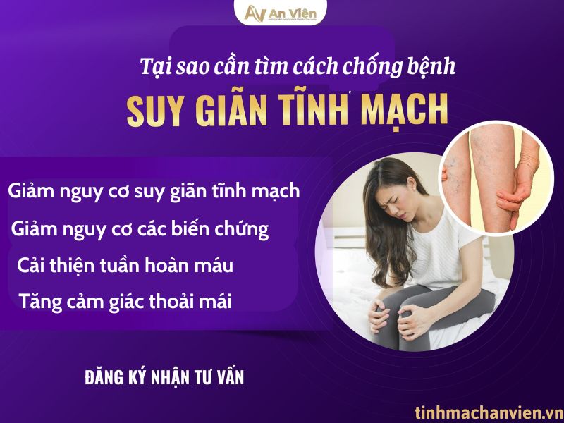 Điểm tên 9 cách chống giãn tĩnh mạch chân tại nhà đơn giản 9 cách chống giãn tĩnh mạch chân